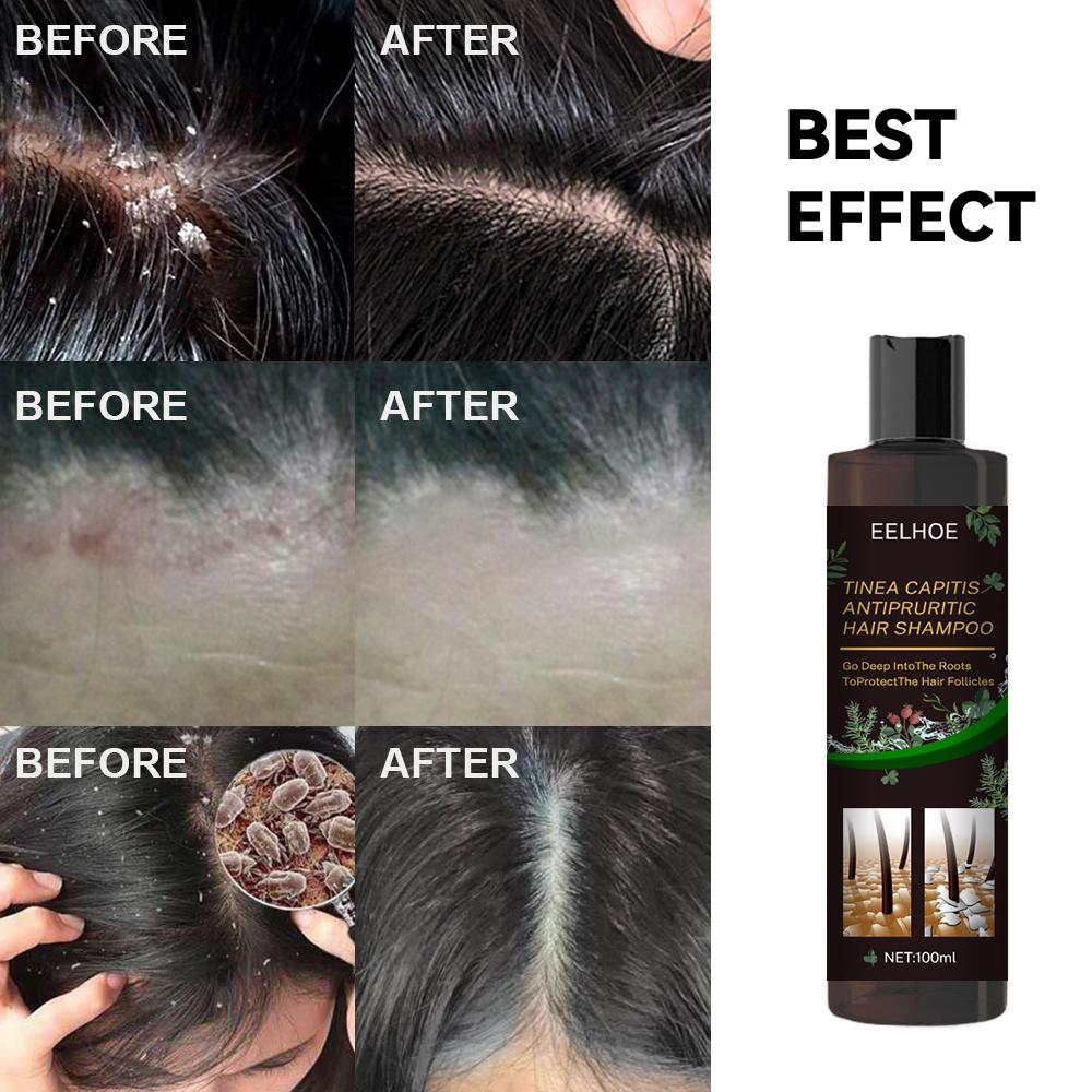 Clear Scalp Botanical Anti-Dandruff Shampoo